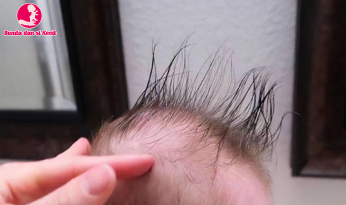 Perhatikan Rambut Bayi Anda untuk Memprediksi Kesehatannya: Tips yang Harus Ibu Ketahui